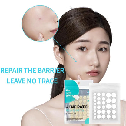 30 Patchs Anti-Acné Hydrocolloïde Salicylique – Invisible & Réparateur