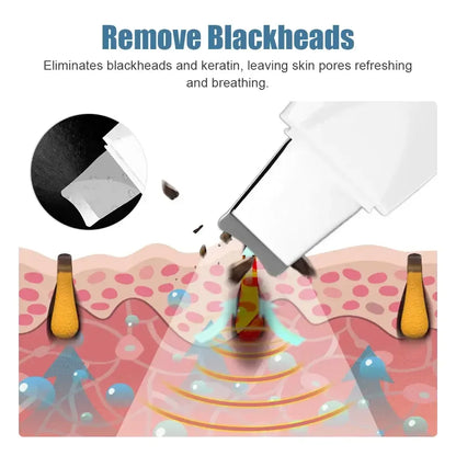 Spatule Vibration Profonde – Nettoyage Pores & Anti-Points Noirs