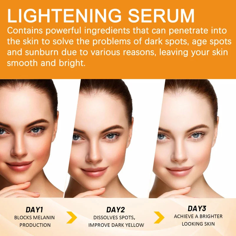 Radiance Vitamin C Serum 50ml – Hyaluronic Acid & Anti-Spot