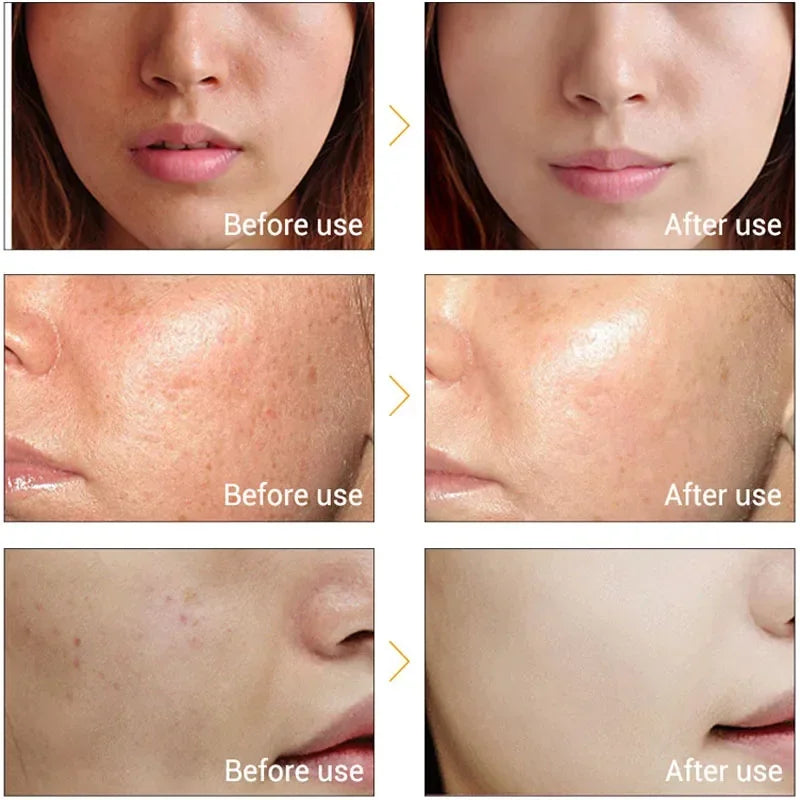 Appareil Beauté Ultrasonique – Anti-Âge & Lifting Ionique Visage