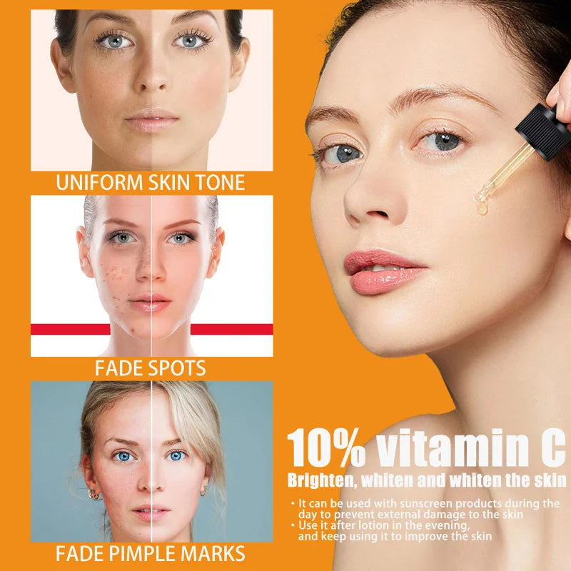 Radiance Vitamin C Serum 50ml – Hyaluronic Acid & Anti-Spot