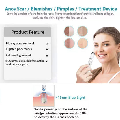 Blue Light Laser Pen – Anti-Acne, Spots & Visible Veins